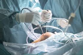 Gastroenterologist-Pune